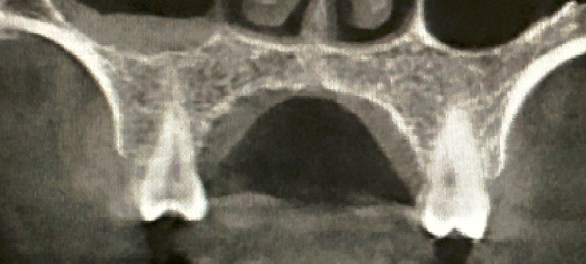 148375.png 1a.png