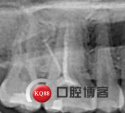 黄玲.jpg