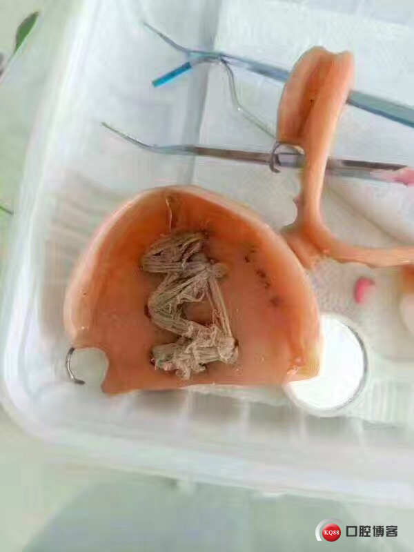 绝对经典的修补方式.jpg