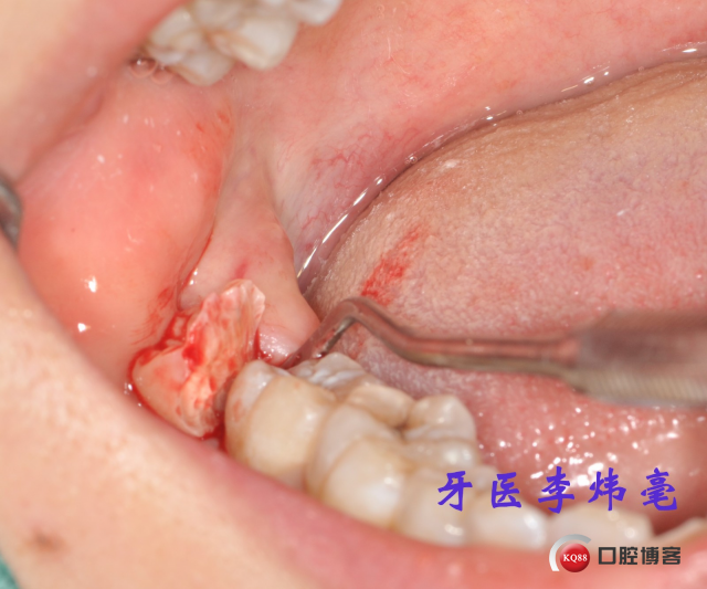 DSC_0144 - 副本.JPG