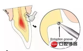 640.webp (2)_副本.jpg