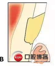 640.webp (5)_副本.jpg