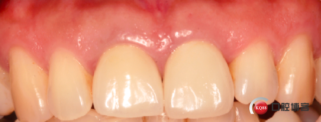 1507020315_595339.png 41.png