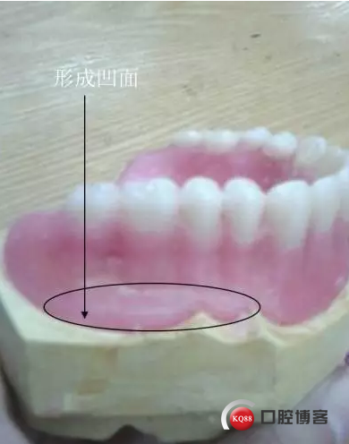 12.png
