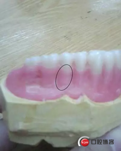 15.png