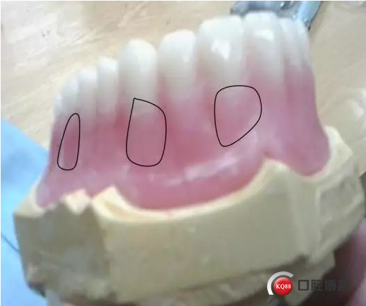 166.png