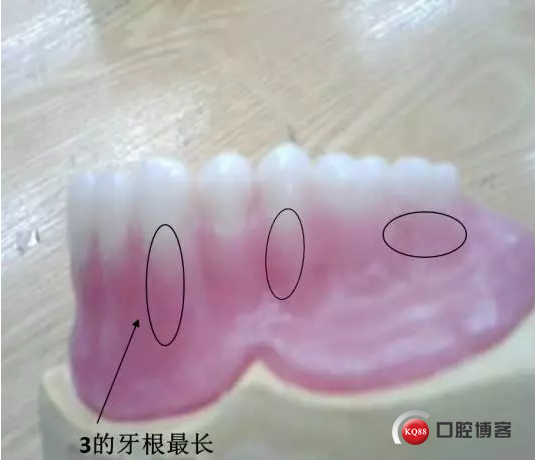 17.png
