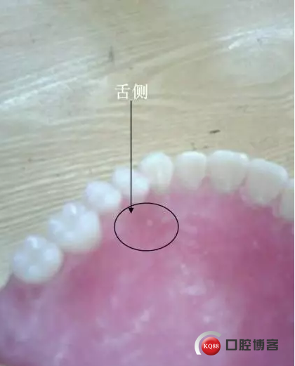 5.png