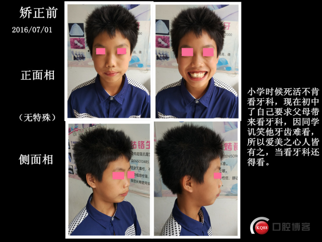 二.jpg