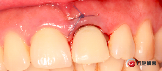 1511514204_401526.png 57.png