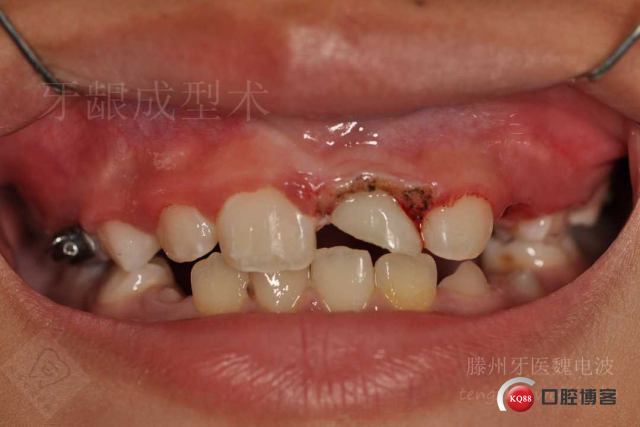 幻灯片14.jpg