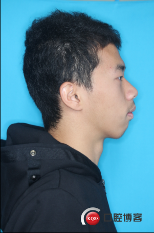 QQ截图20171219164526.png