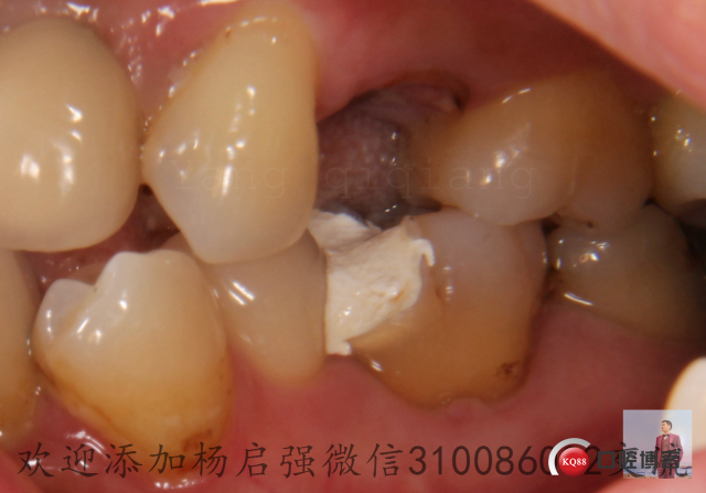 IMG_0026.JPG