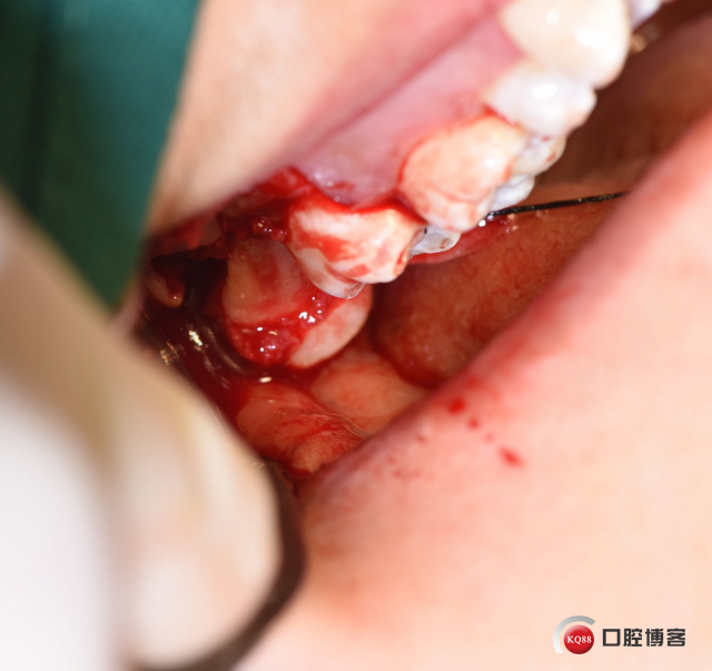 DSC_1944_副本.jpg
