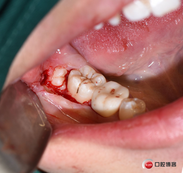 DSC_1956_副本.jpg