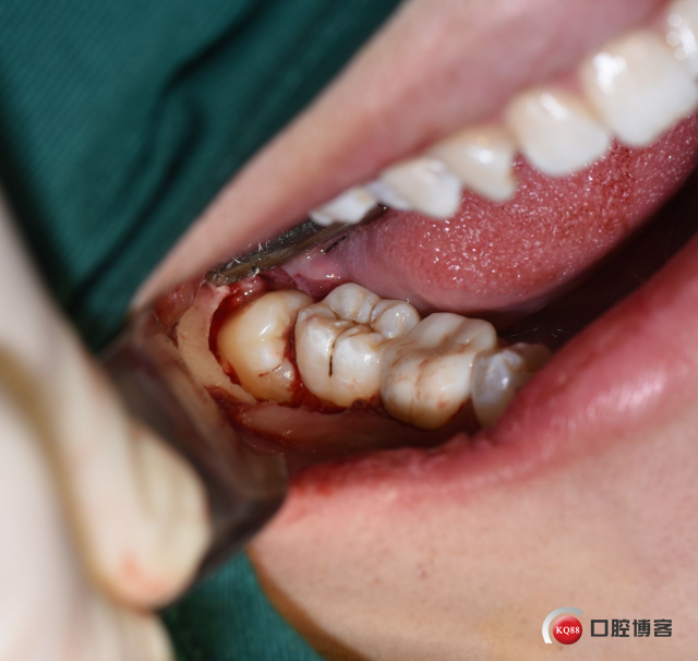 DSC_1960_副本.jpg