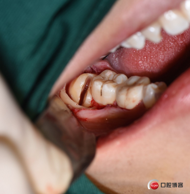 DSC_1962_副本.jpg