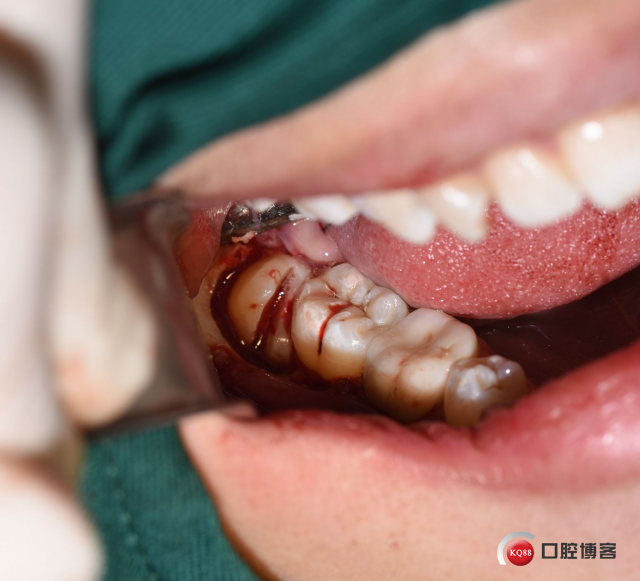 DSC_1964_副本.jpg
