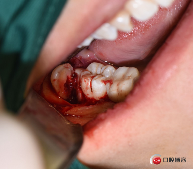 DSC_1965_副本.jpg