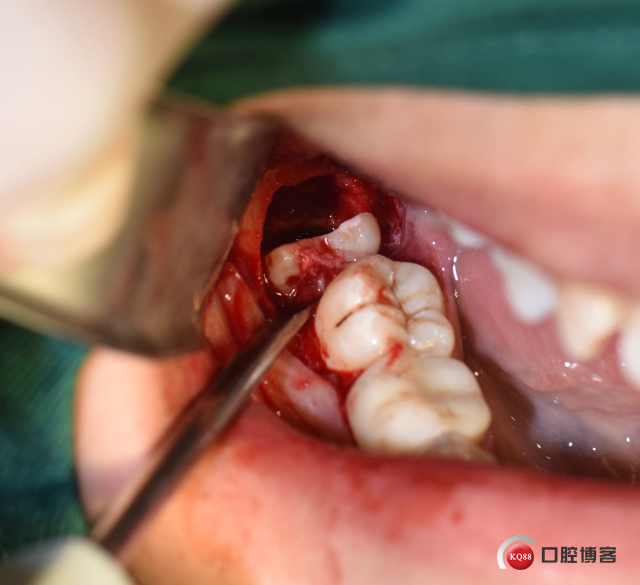 DSC_1971_副本.jpg
