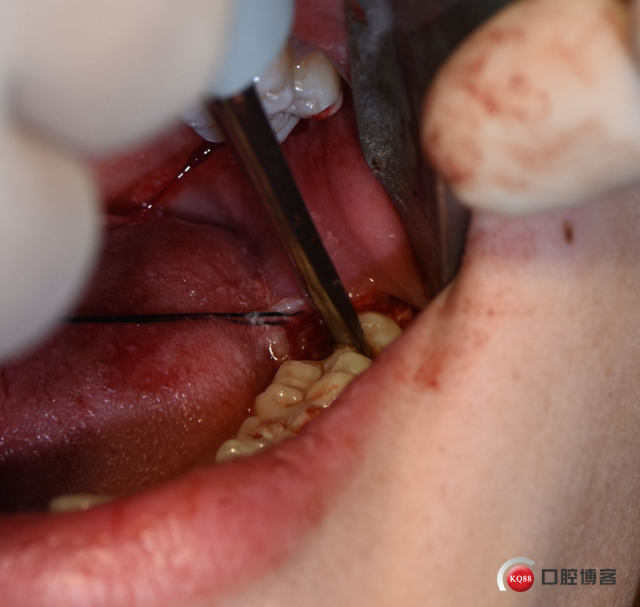 DSC_1994_副本.jpg