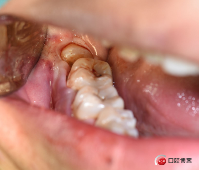 DSC_1738_副本.jpg