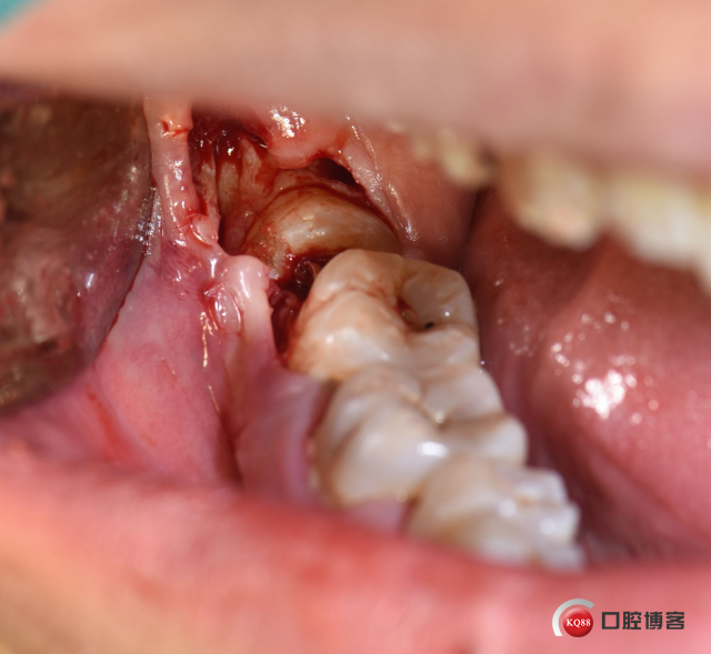 DSC_1740_副本.jpg