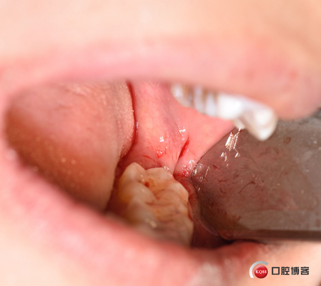 DSC_2095_副本.jpg
