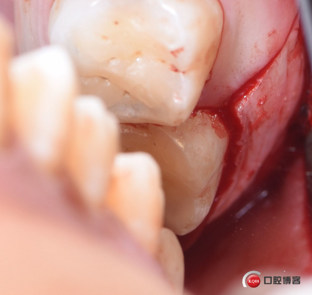 DSC_2101_副本_看图王.jpg