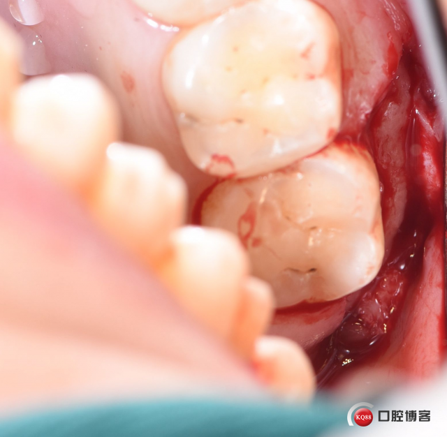 DSC_2102_副本_看图王.jpg