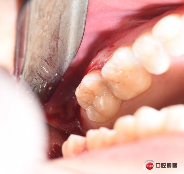 DSC_2120_副本_看图王.jpg