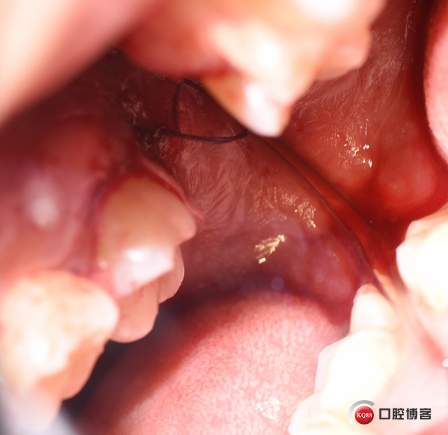 DSC_2124_副本_看图王.jpg