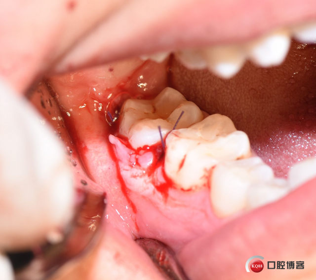 DSC_2147_副本.jpg