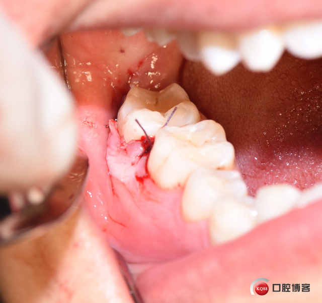 DSC_2148_副本.jpg