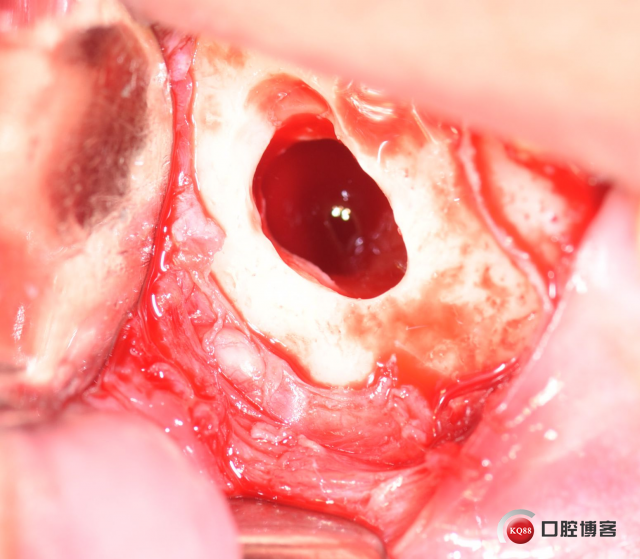 DSC_1871_副本.jpg