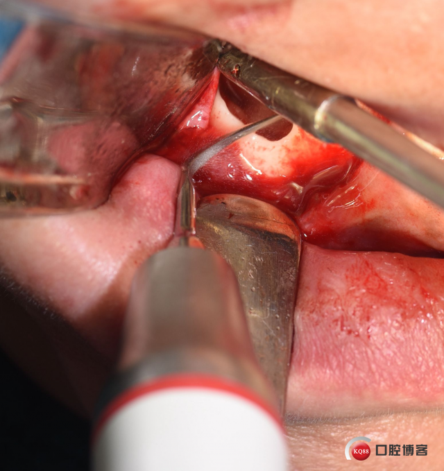 DSC_1879_副本.jpg