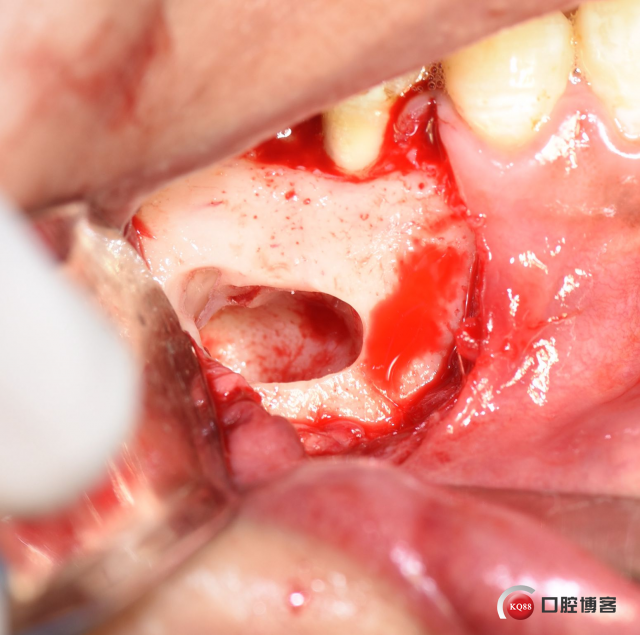 DSC_1881_副本.jpg