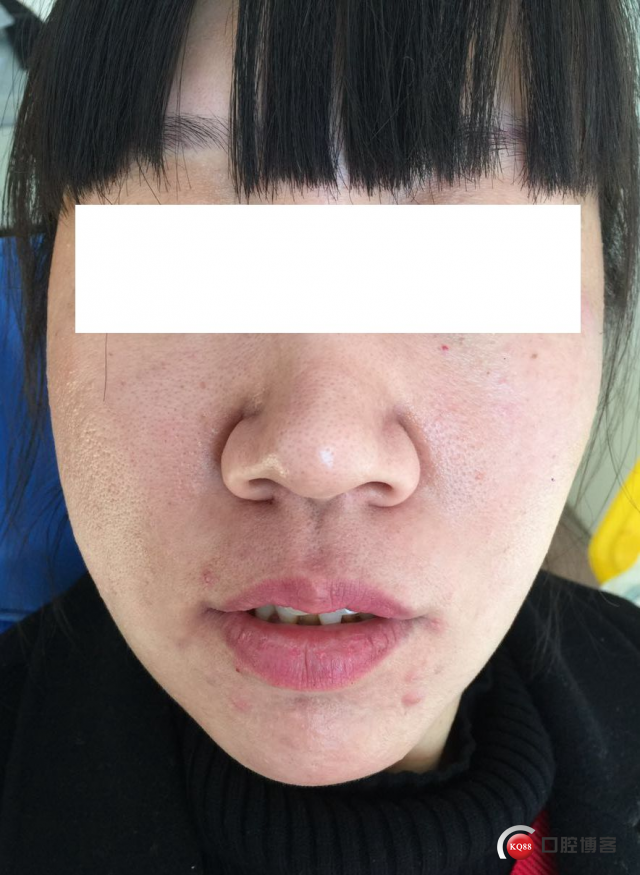 627877992509486578_副本.jpg