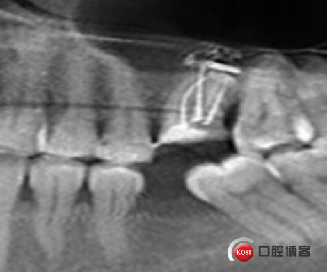 blob.png