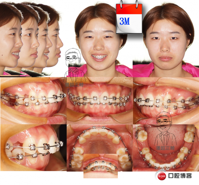 未标题-1 拷贝_看图王.jpg