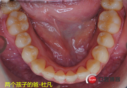 1525087412_329432.jpg 11_副本.jpg