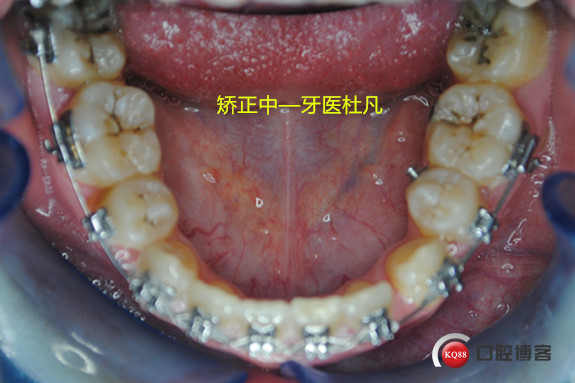 1526195162_530137.jpg 5_副本.jpg
