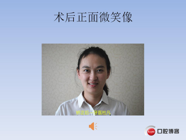 一例看似简单的前牙反牙合_50.jpg