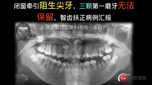 Forum病例投稿-潘超-南昌解放军第94医院.001.jpg