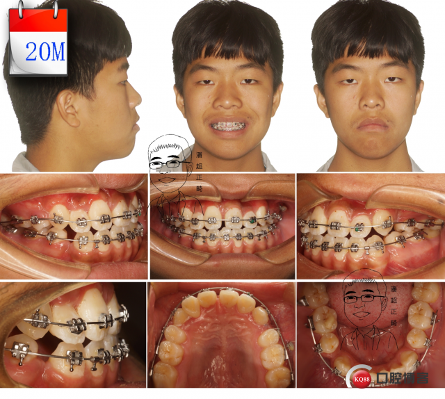 20 拷贝_看图王.jpg