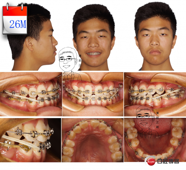 26 拷贝_看图王.jpg