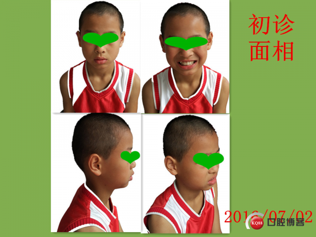 二.jpg