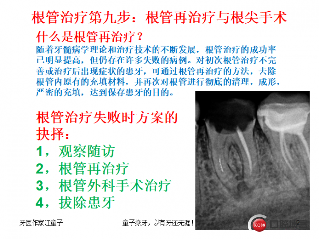 根管再治疗与根尖手术5.png