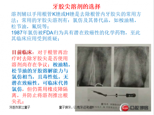 根管再治疗与根尖手术9.png