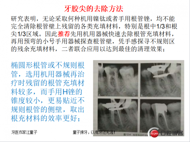 根管再治疗与根尖手术10.png
